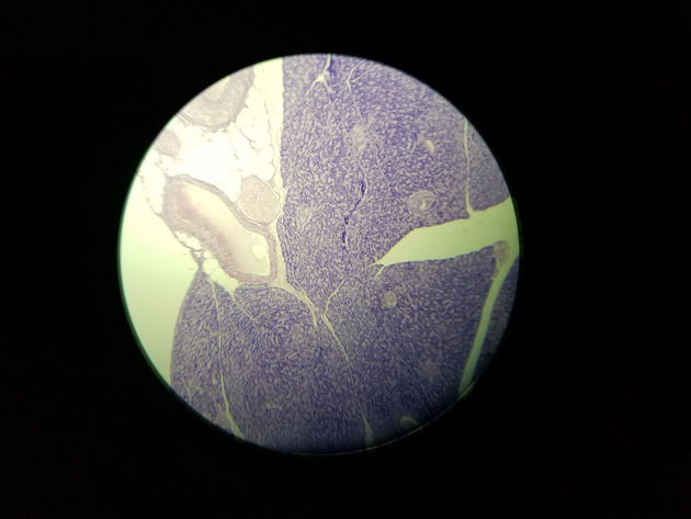 Pancreas Slides - Pancreas 005 40X